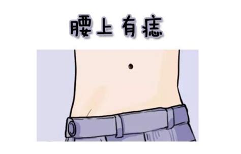 腰上长痣